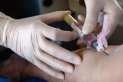 Preocupa alta incidencia  de anemia ferropénica en  niños y adultos mayores