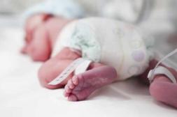 El 10 % de los nacimientos  en Uruguay son prematuros