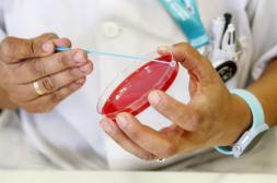 El MSP confirma un nuevo caso de  sarampión y refuerza la vigilancia 