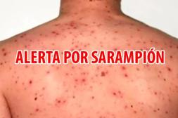 MSP alerta por situación del sarampión  y exhorta a toda la población vacunarse