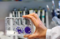 Argentina confirmó primera muerte por gripe H3N2 y crece alerta sanitaria en la región ante alta movilidad