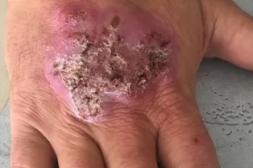 Advierten por una nueva especie de conocido hongo infeccioso que lo transmiten los gatos a los humanos