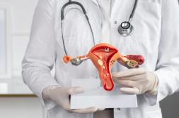 “El cáncer de cuello de útero  se puede prevenir y lograrlo  está al alcance de todas” 