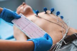Jornada Académica de Electrocardiograma en Emergencia impulsará la capacitación médica en la Semana del Corazón