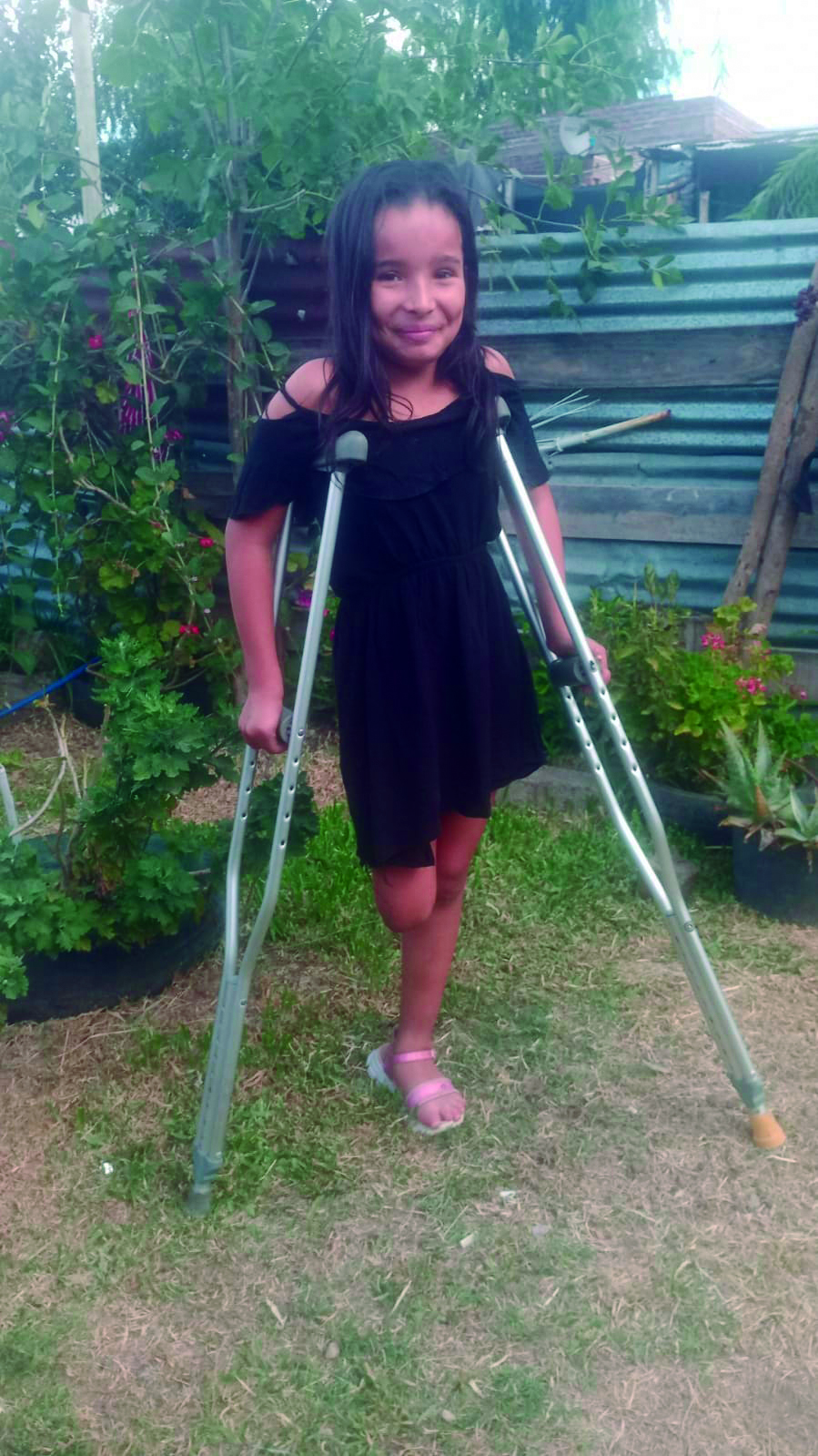 Vallolet Araujo de solo 9 años necesita una pierna ortopédica para poder mejorar su calidad de vida
