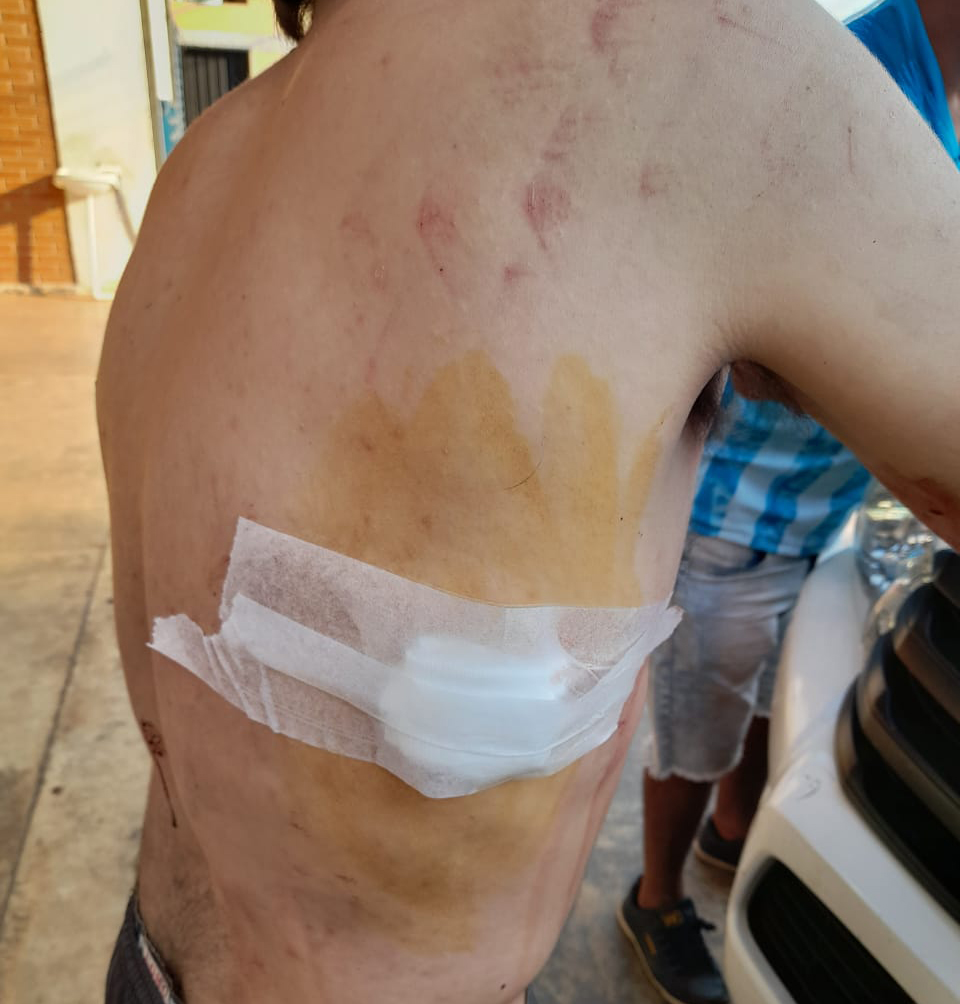 Fue herido de arma blanca pero no quiso aportar datos