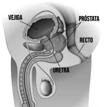 Cáncer de próstata: detectan cada  vez más casos en hombres jóvenes