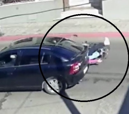 Víctima del siniestro con fuga no  podrá caminar por mucho tiempo