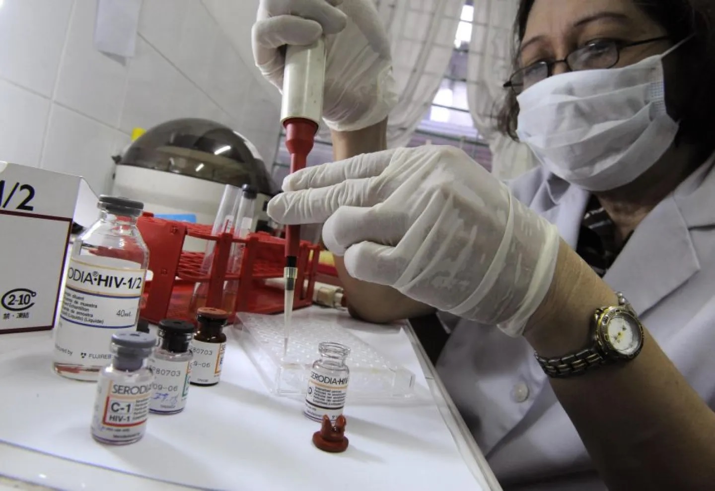 Se constató en 2024 la menor  cifra de muertes por SIDA del  quinquenio con 114 fallecidos