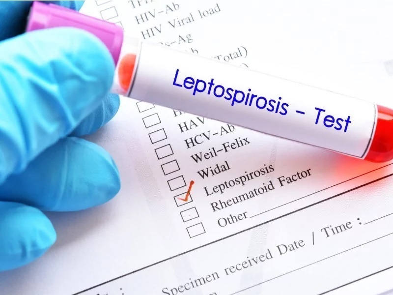 Caso dudoso de leptospirosis  activa consejos de prevención